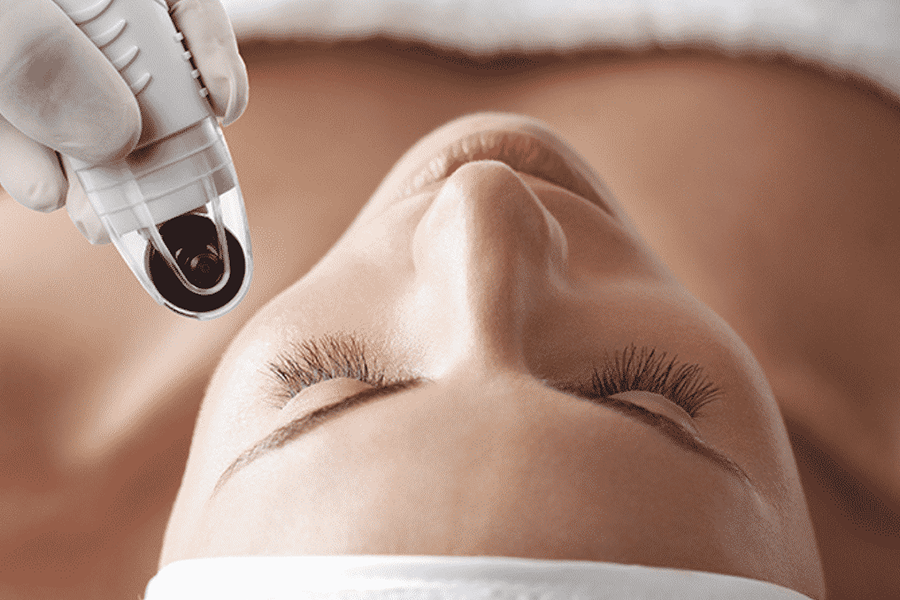 Reveal Your Most Radiant Skin Yet with Dermafrac at Temple Day Spa
