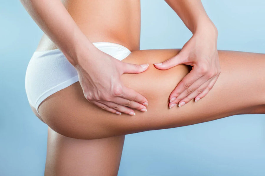 Smoother Skin, Greater Confidence: The Science of Our Cellulite Reduction Therapy